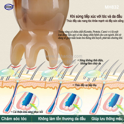 Bạch tuộc Massage đầu bằng sừng (MH832) mát xa giúp lưu thông máu, Chăm sóc sức khỏe