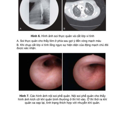Sách - Cấp cứu hồi sức nhi khoa ( trọn bộ, xuất bản 2025)