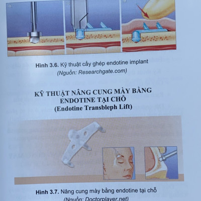 Sách - Tạo hình thẩm mỹ Đầu - Mặt - Cổ & Mông - Chân - Tay