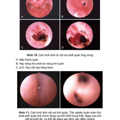 Sách - Cấp cứu hồi sức nhi khoa ( trọn bộ, xuất bản 2025)