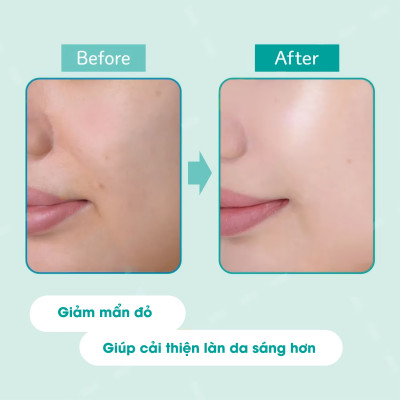 Kem Chống Nắng Nâng Tone Kose Suncut Tone Up Uv Essence Gn Spf50+ Pa++++ 80G ( Màu Xanh Mint )