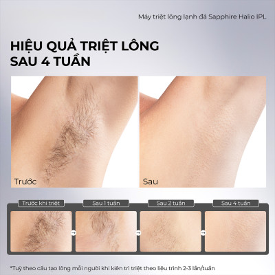 Máy Triệt Lông Lạnh Sapphire Halio InfinityGlow Advanced IPL Sapphire Cooling Hair Removal Device