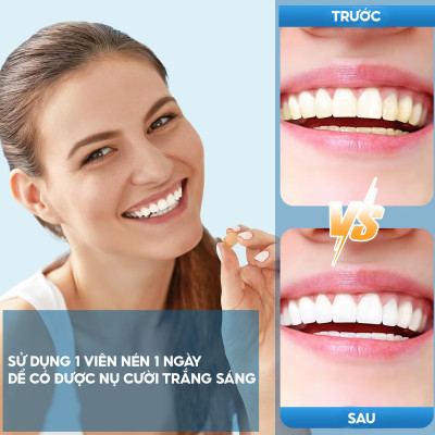 Đầu tăm nước cho máy h2ofloss với 30 viên trắng răng cho hơi thở thơm mát và răng trắng sáng tự nhiên
